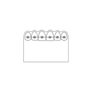 Full Color Process - Teeth With Braces Design - Creative Top Flexible Magnet With Scalloped Top
