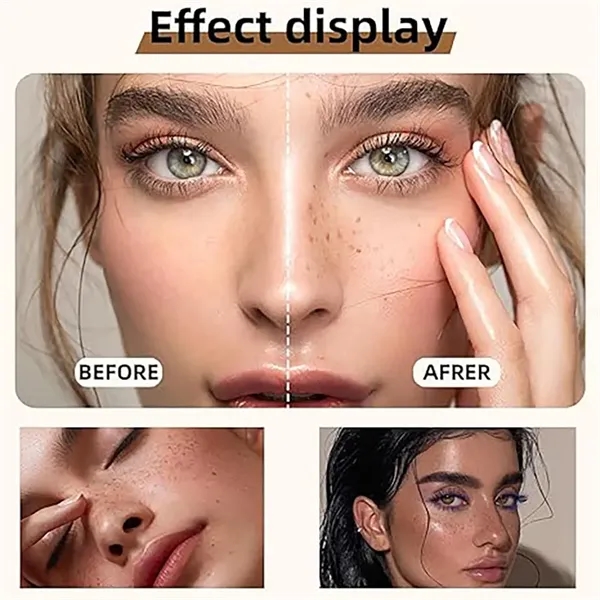 Bulk Customizable Freckle Stamps For Beauty Suppliers - Bulk Customizable Freckle Stamps For Beauty Suppliers - Image 2 of 3