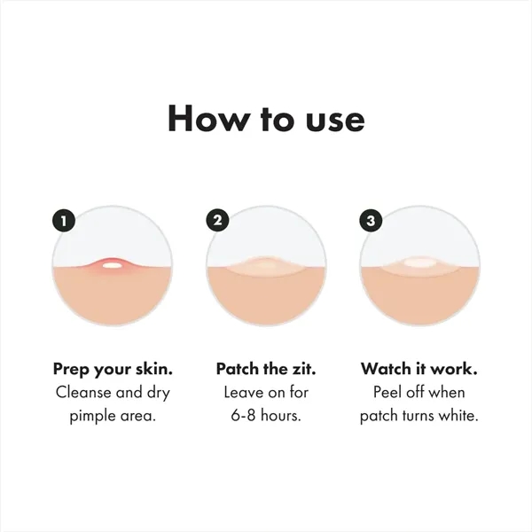 Invisible Acne Patch - Fast & Gentle Treatment - Invisible Acne Patch - Fast & Gentle Treatment - Image 6 of 8