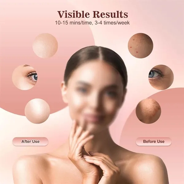 Beauty aids portable red light therapy face mask with remote - Beauty aids portable red light therapy face mask with remote - Image 3 of 4