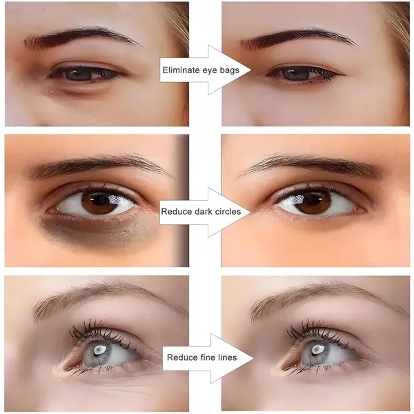 Under Eye Light Therapy Massager - Under Eye Light Therapy Massager - Image 1 of 4